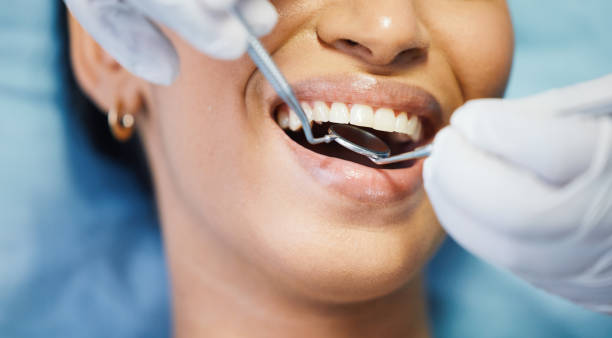 Best Emergency Dentist for Lost Fillings or Crowns in Diamondhead, MS